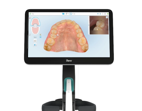 Intra-Oral Scanner Device